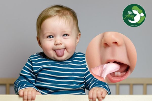 Nước rơ lưỡi giúp vệ sinh khoang miệng cho trẻ sơ sinh