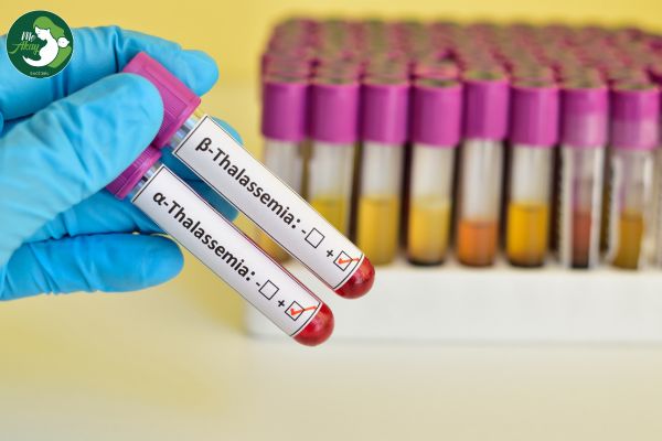 Thalassemia ảnh hưởng như thế nào tới thai nhi